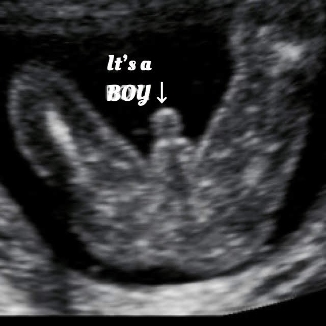 21 week baby ultrasound