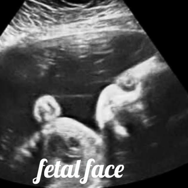fetal face