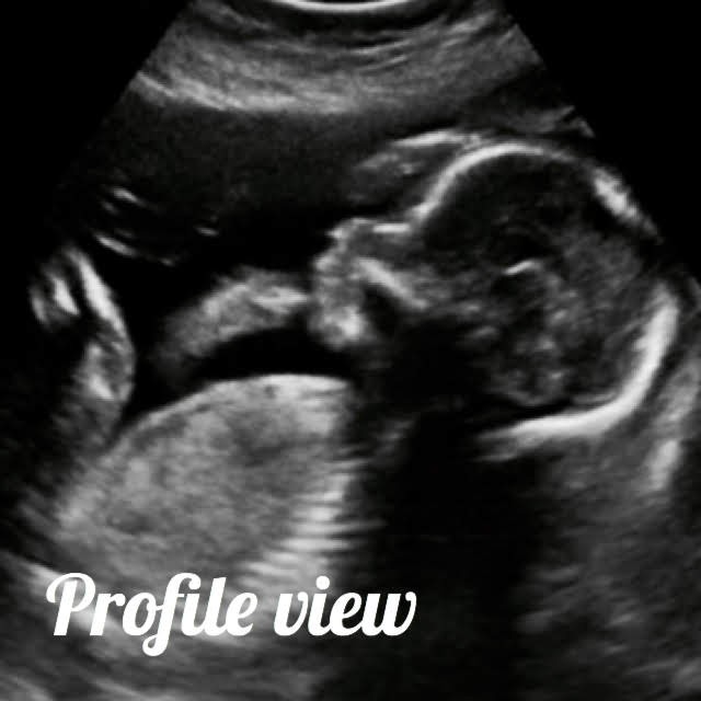 fetal profile view