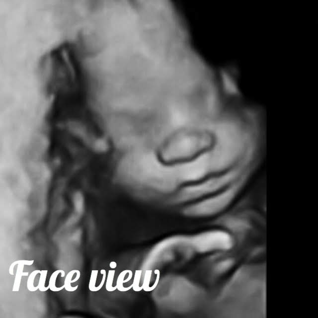 fetal face