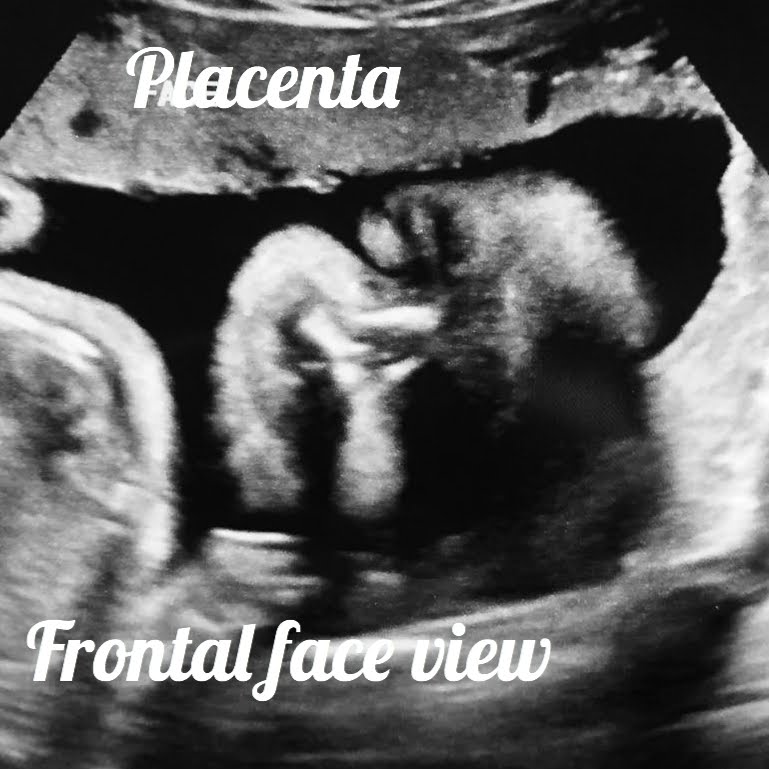 frontal face view of a baby seen on ultrasound/ Normal 29-week pregnancy