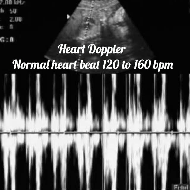ultrasound image of a baby at 32 weeks, showing the heart doppler