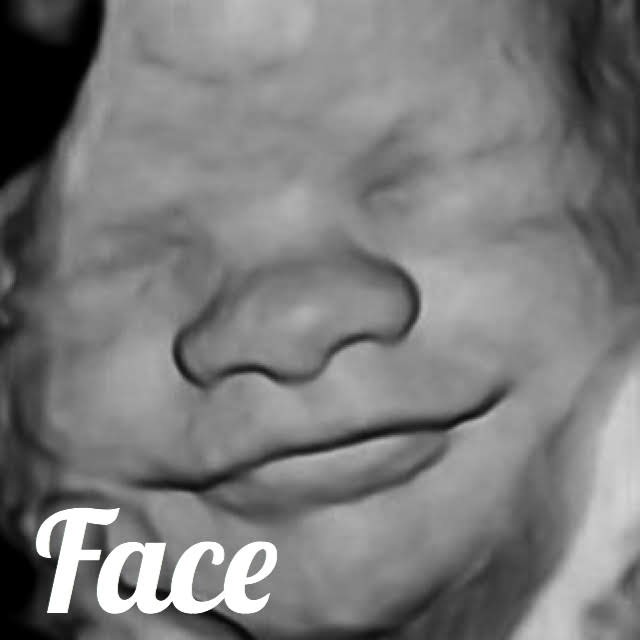 3d ultarsound image of a baby's face