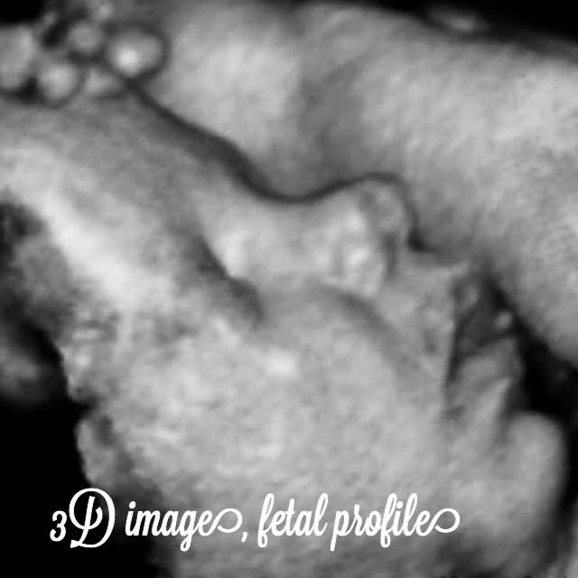 36 weeks pregnancy and ultrasound