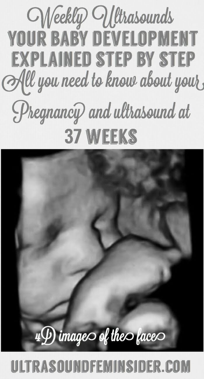 37 weeks pregnancy and ultrasound