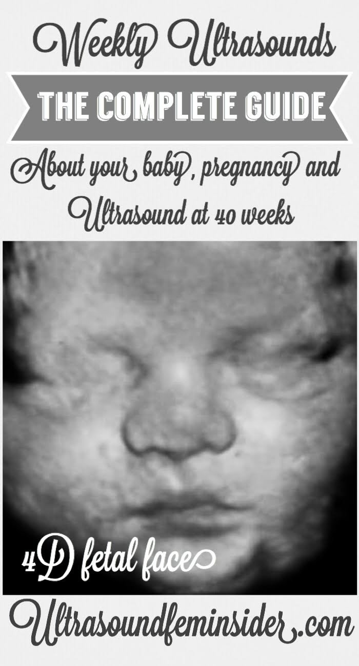 37 weeks pregnancy and baby ultrasound