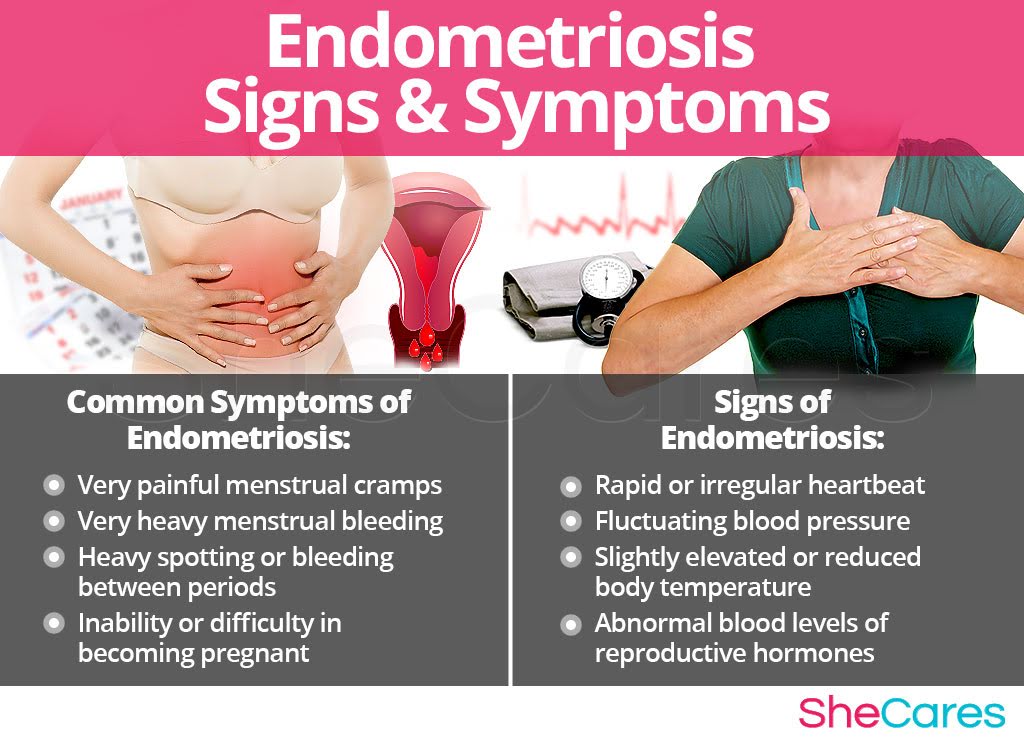 Endometriosis, Endometriosis Symptoms, Diagnosis And Treatments ...