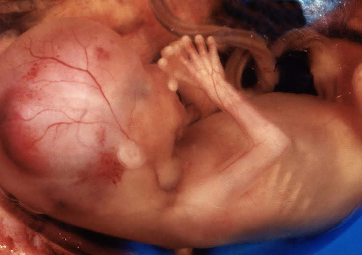 normal 16 week baby ultrasound
