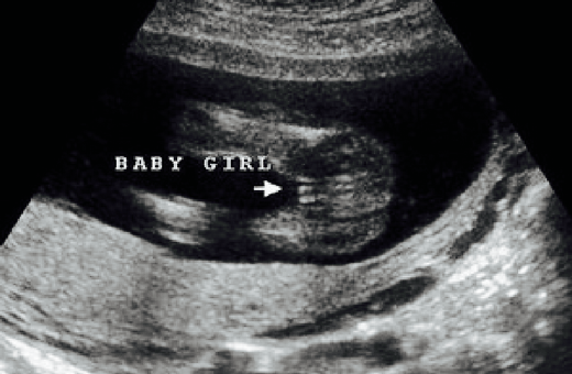 16 week ultrasound