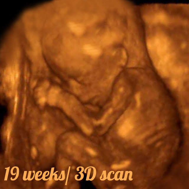 19 week Fetal pregnancy and ultrasound