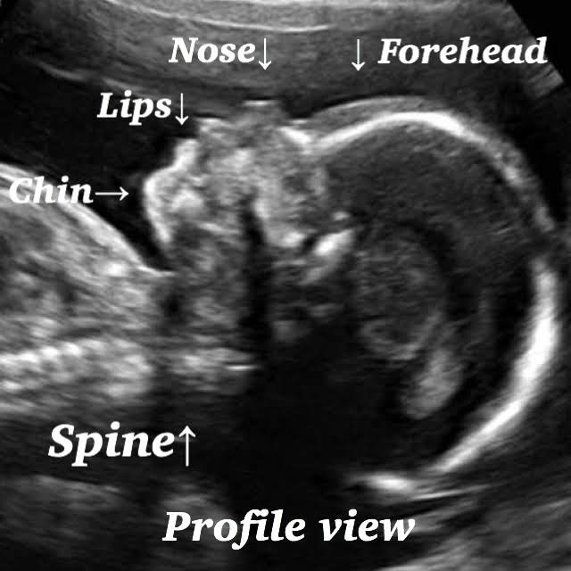 21 week baby ultrasound