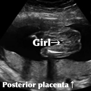 Normal 29 week baby ultrasound. - Ultrasoundfeminsider