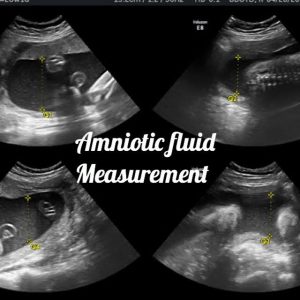 Normal 36 week baby ultrasound. - Ultrasoundfeminsider