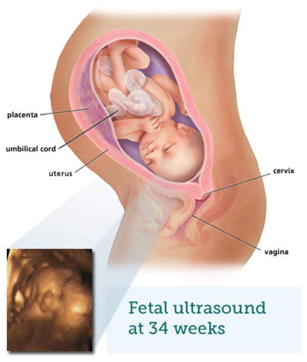  34 week pregnancy and ultrasound