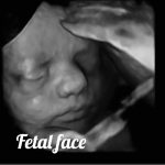 Normal 34 week baby ultrasound. - Ultrasoundfeminsider