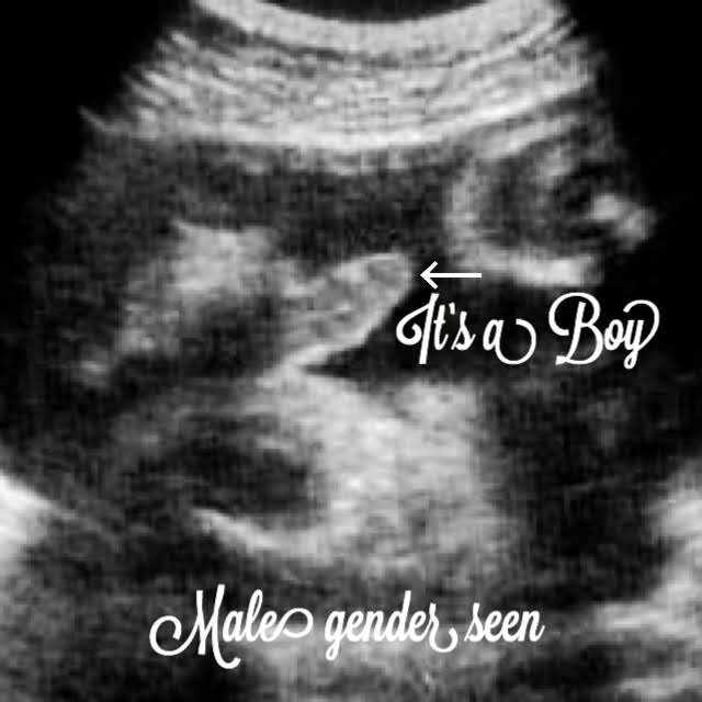 40 week baby ultrasound