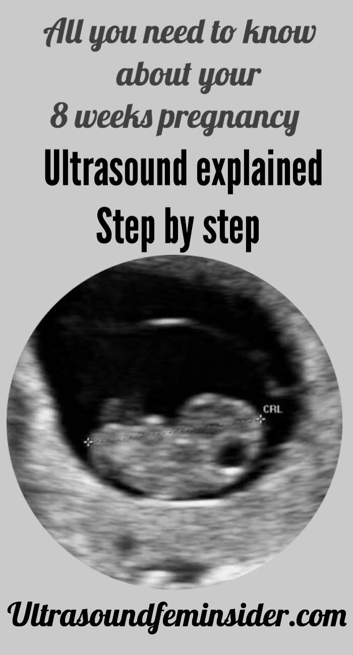 8 weeks pregnancy and ultrasound