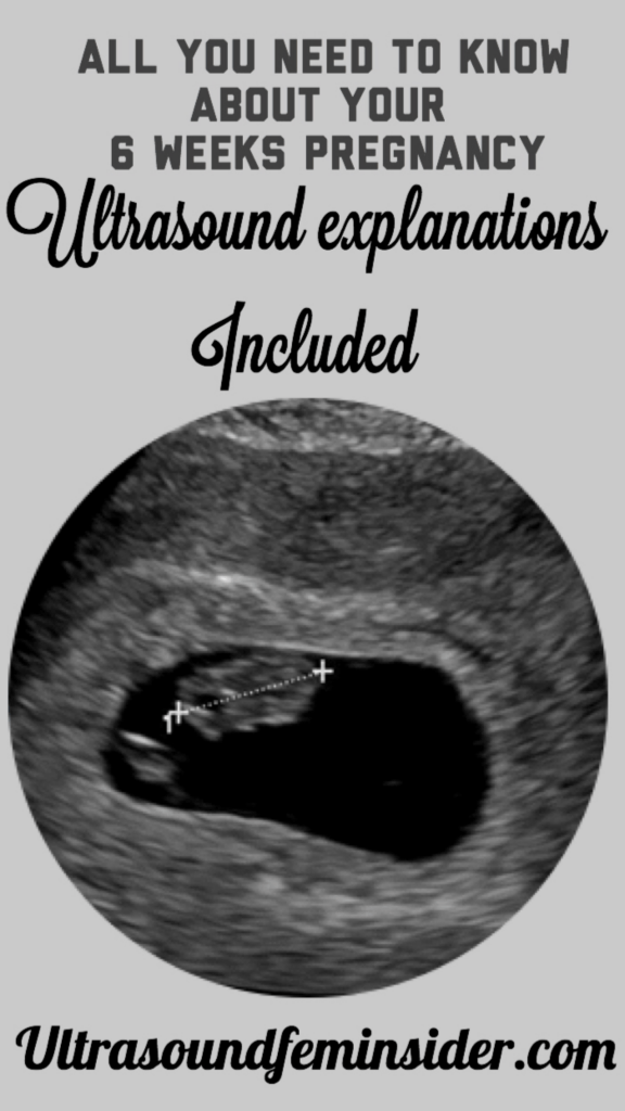 Normal first trimester 6 weeks ultrasound. - Ultrasoundfeminsider