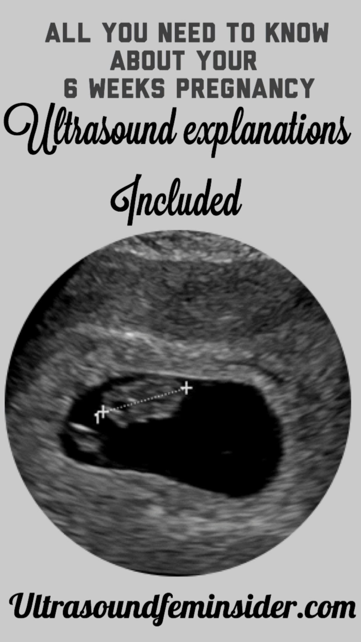 6 weeks baby ultrasound.