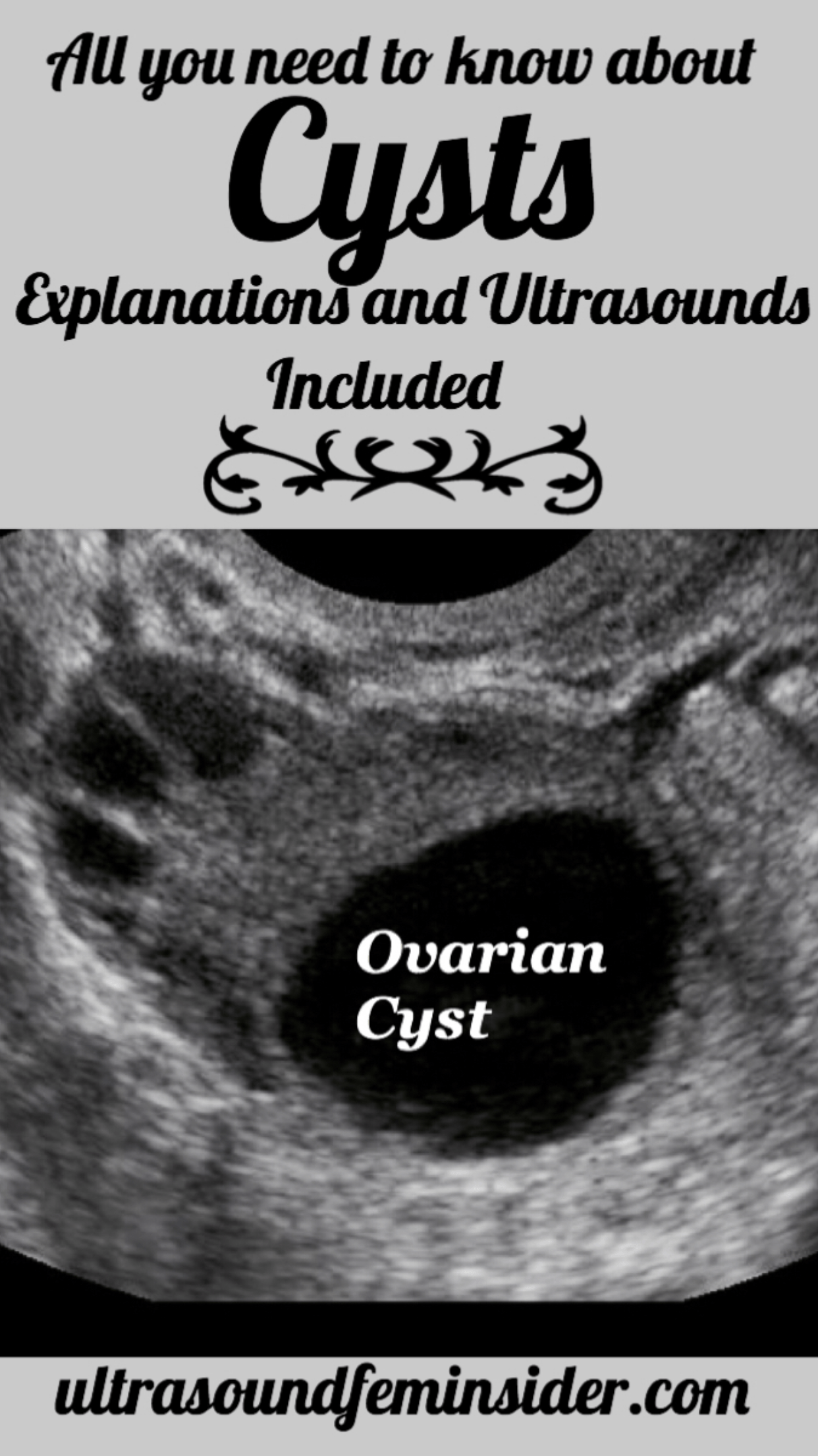 all you need to know about ovarian cysts with ultrasound included