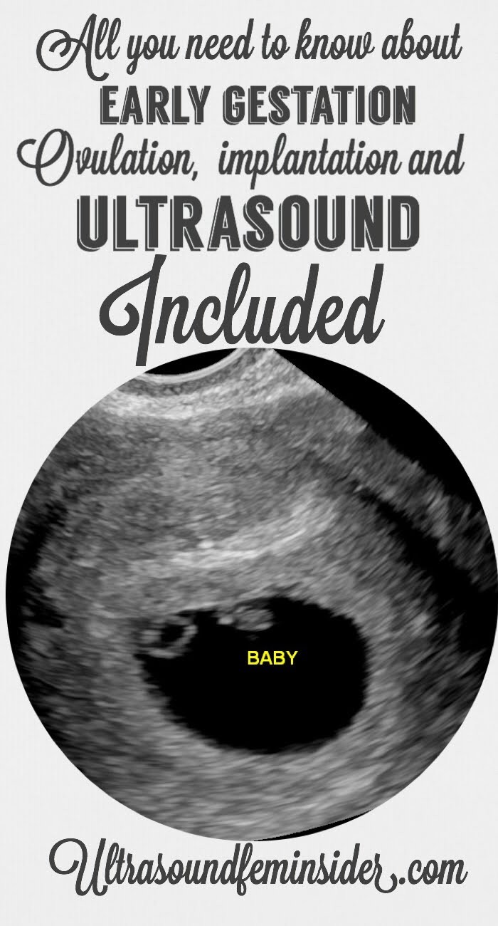 I will walk you through all the important things that you need to know about early gestation and your first appointment with your Gynecologist.  #babyultrasound #pregnancy