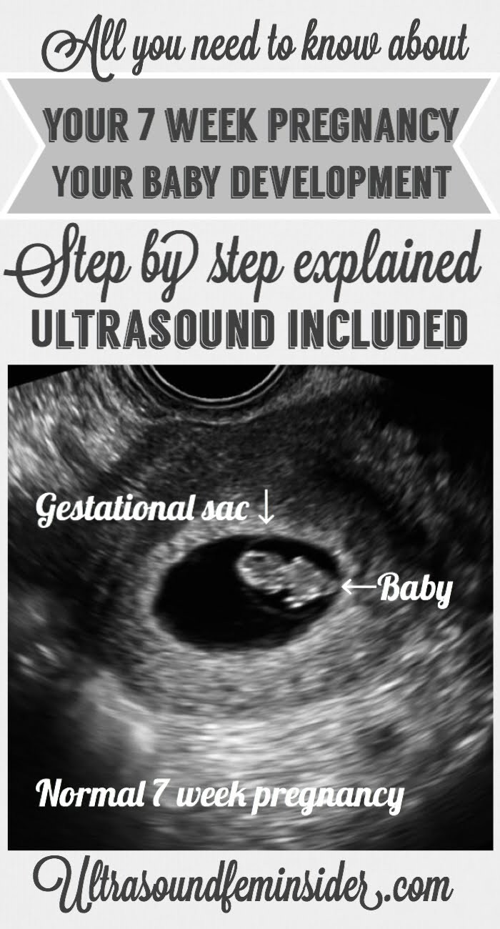 What kind of ultrasound is done at 7 weeks
