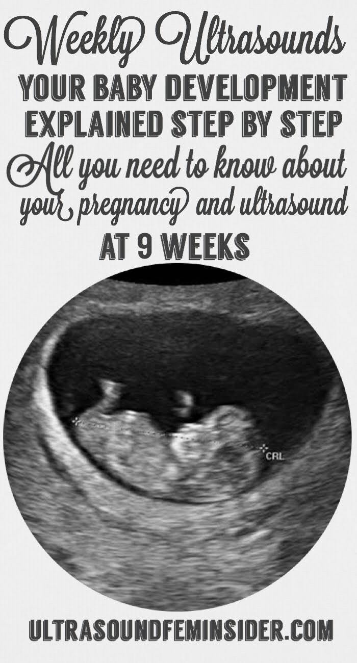 9 weeks baby ultrasound