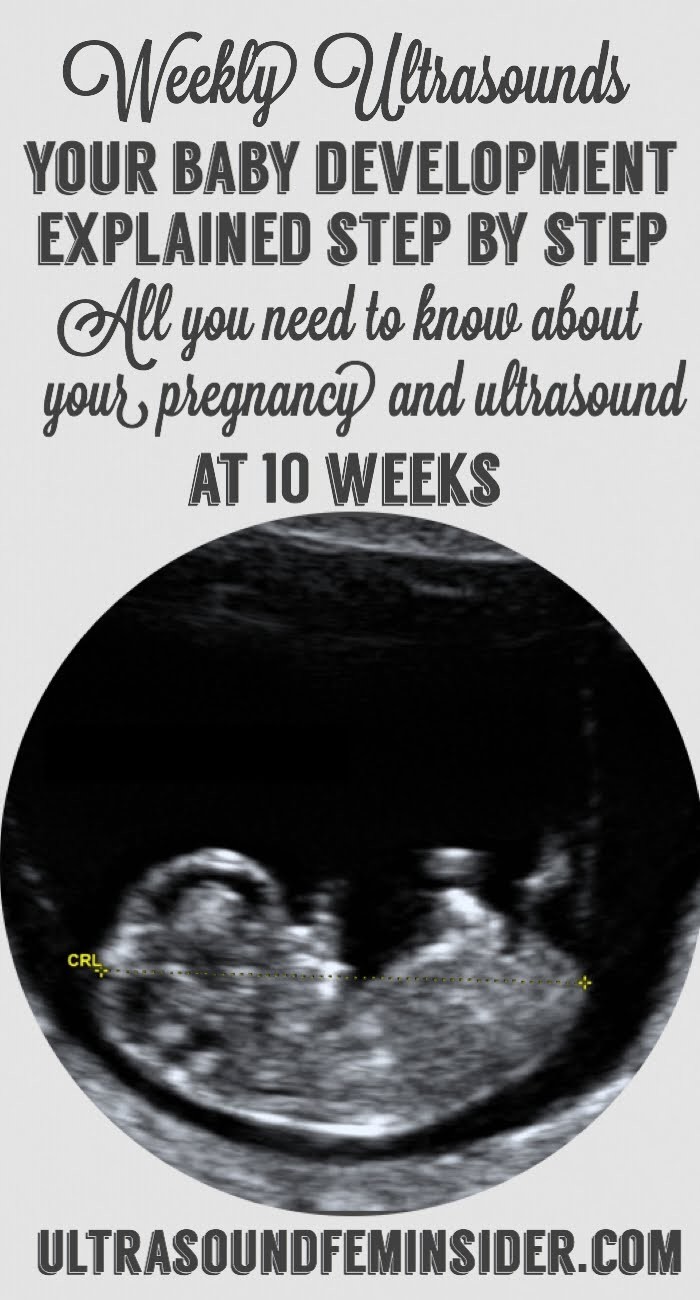 10 weeks pregnancy and ultrasound