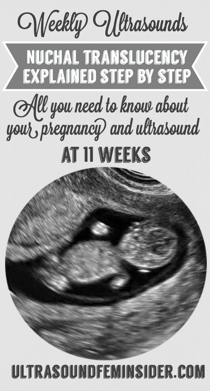 11 weeks nuchal translucency and ultrasound. Nuchal Translucency, CVS and Amnio as well. If you want to learn how your baby is developing at 11 weeks stay with me. As usual, all ultrasound images regarding this topic will be on the middle of the post
