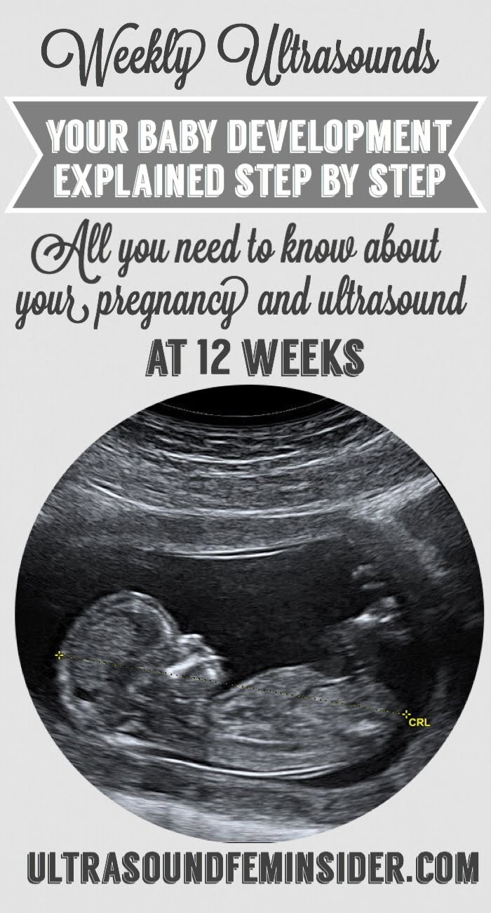 What you need to know about normal 12 week baby ultrasound, Learn about your symptoms, fetal development, doctor visits and tests.