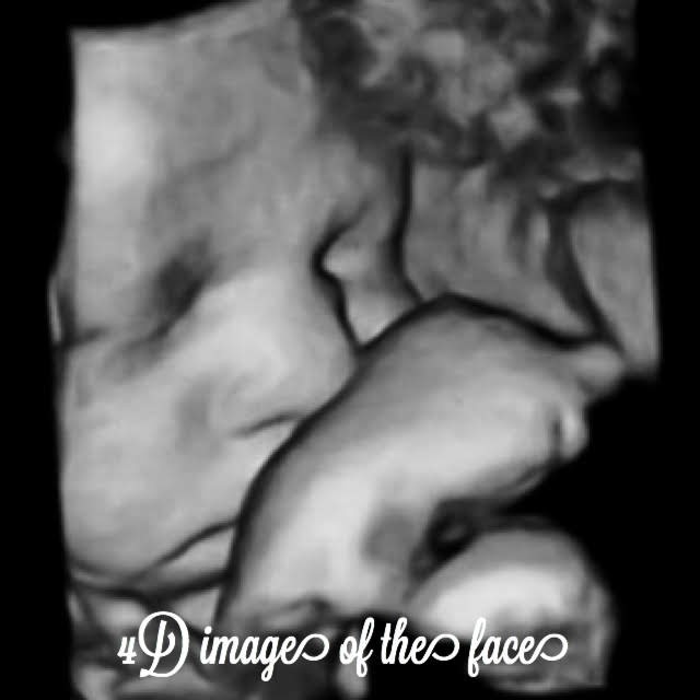 fetal face seen on ultrasound at 37 weeks