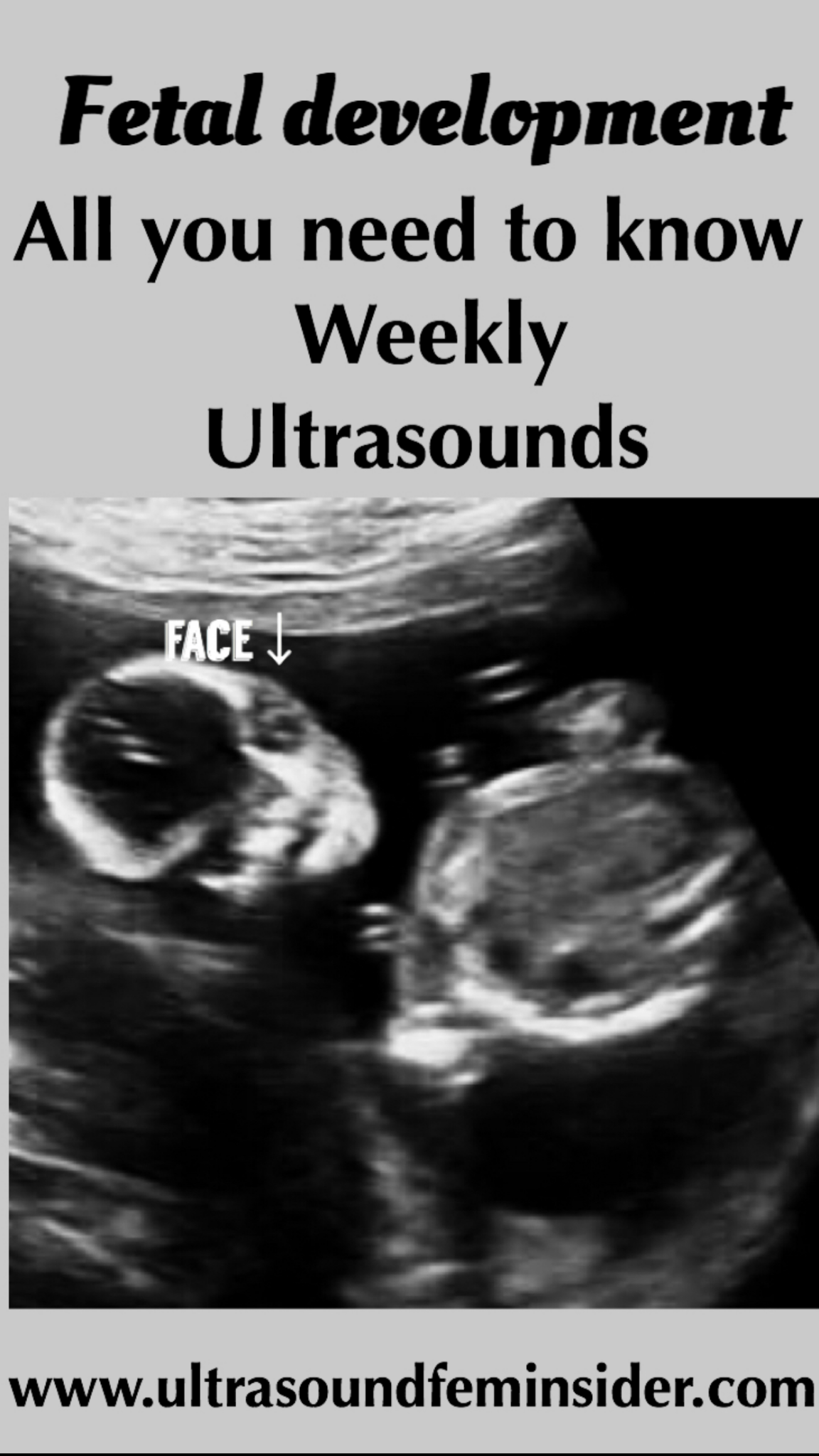 The ultimate guide for your 18 week fetal ultrasounds.