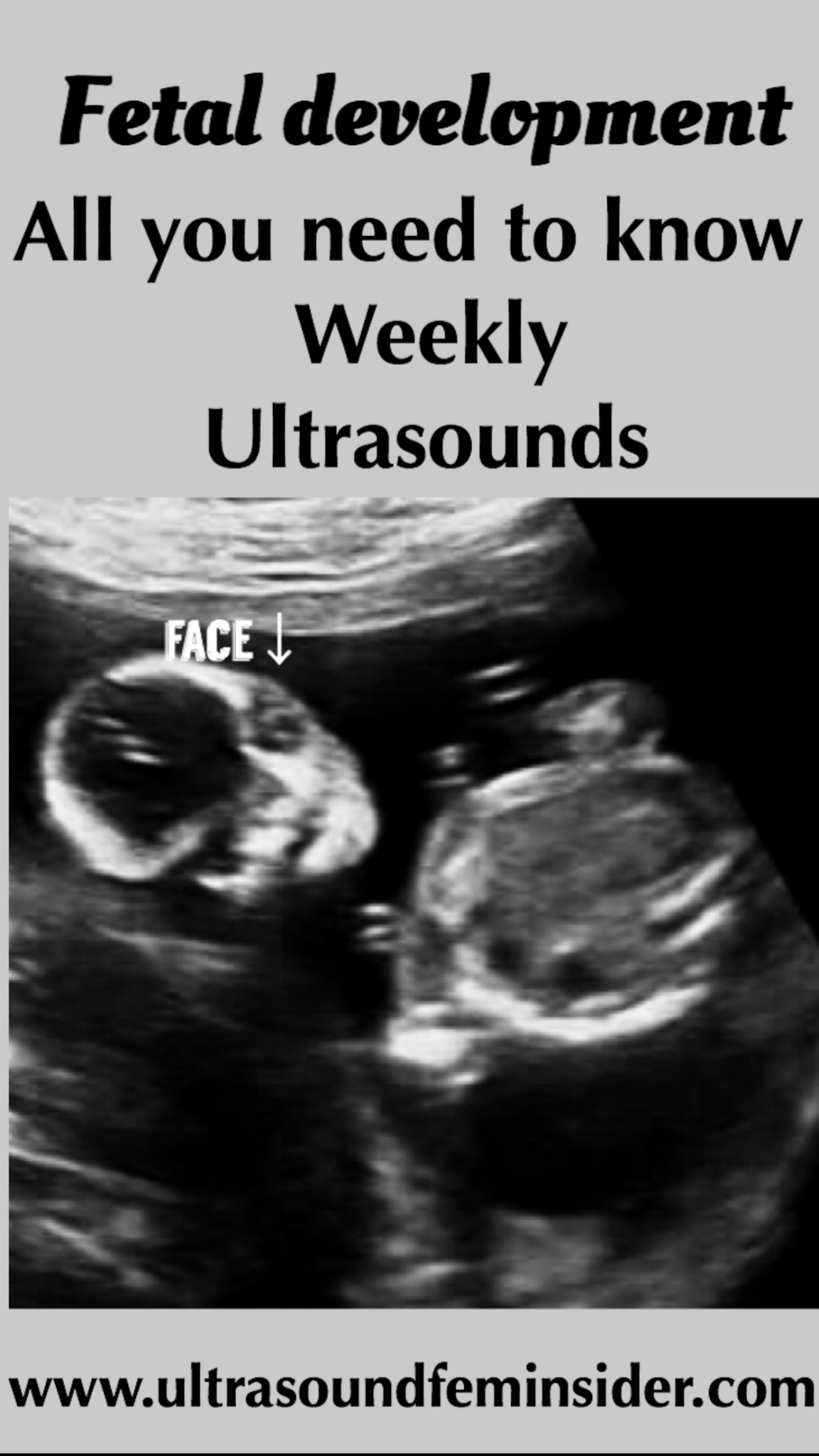 Normal 18 week baby ultrasound. - Ultrasoundfeminsider