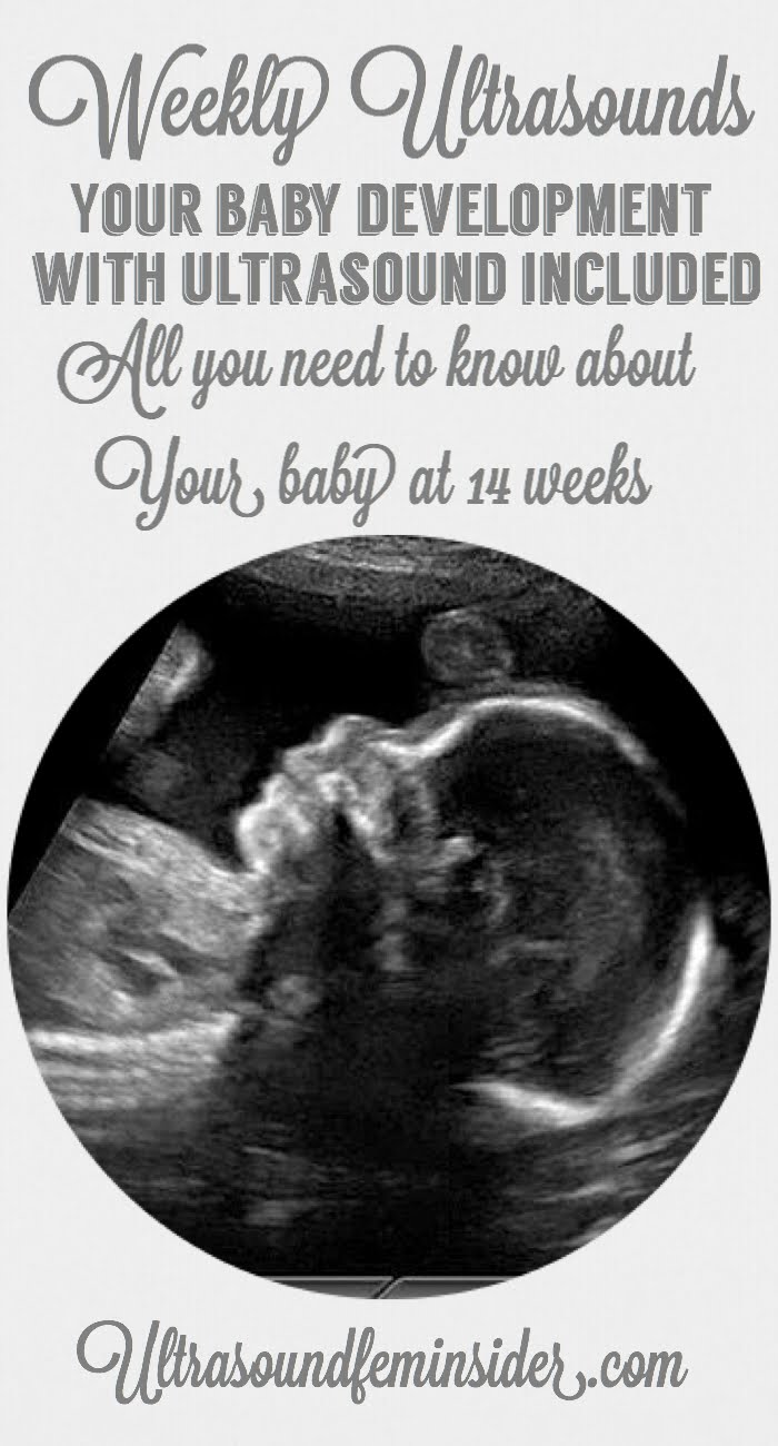 pin about the topic, 14 weeks pregnancy and ultrasound