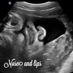 38 week baby ultrasound