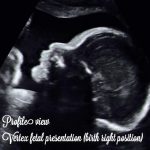 40 week pregnancy and ultrasound