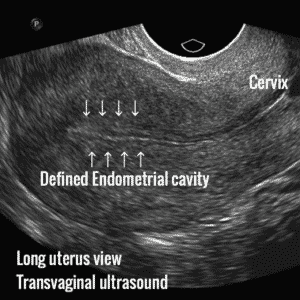 Normal 32 week baby ultrasound. - Ultrasoundfeminsider