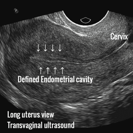 Normal 21 week baby ultrasound. - Ultrasoundfeminsider