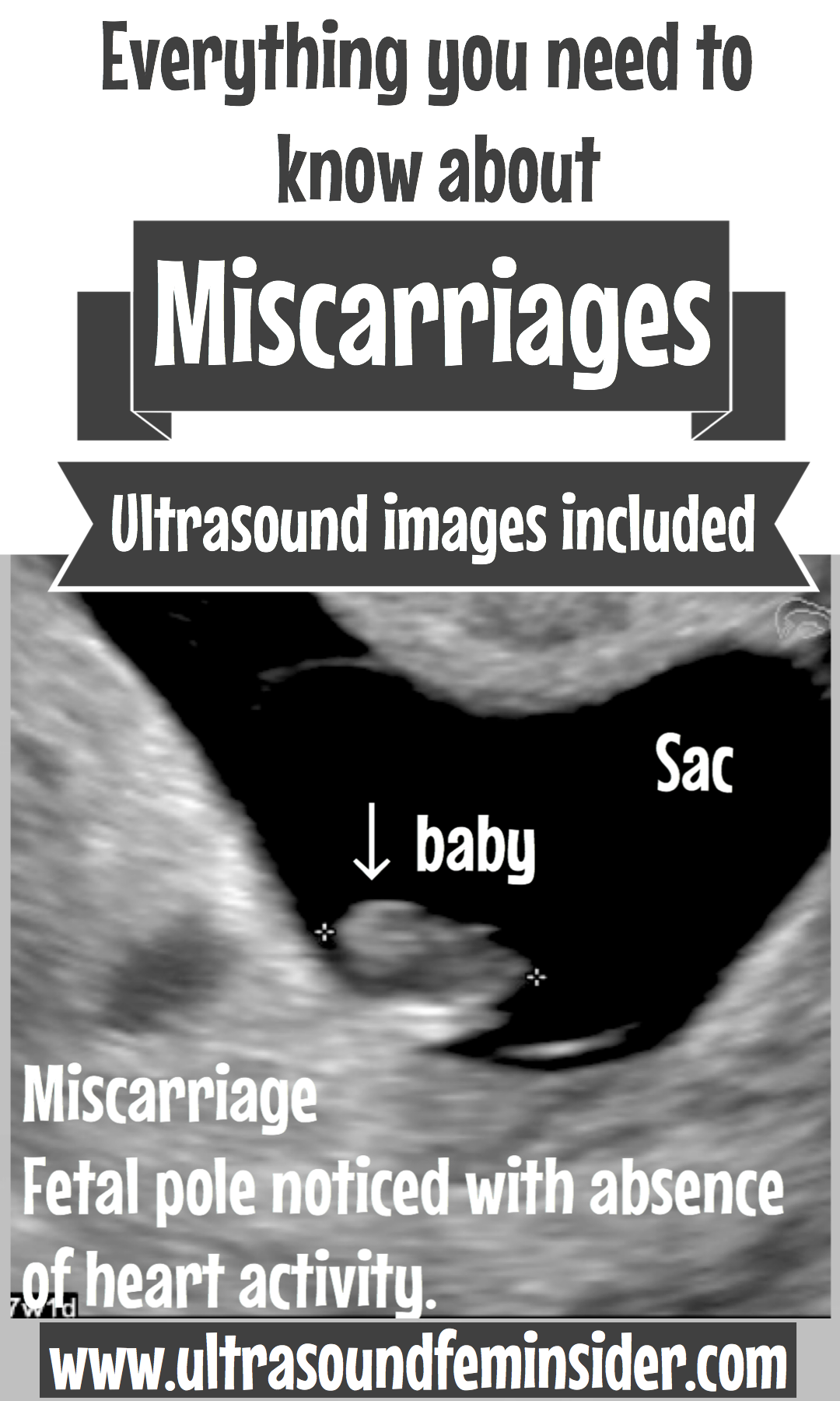Miscarriage means loss of an embryo or fetus before the 20th week of pregnancy. Most miscarriages occur during the first 14 weeks of pregnancy. The medical term for miscarriage is spontaneous abortion.