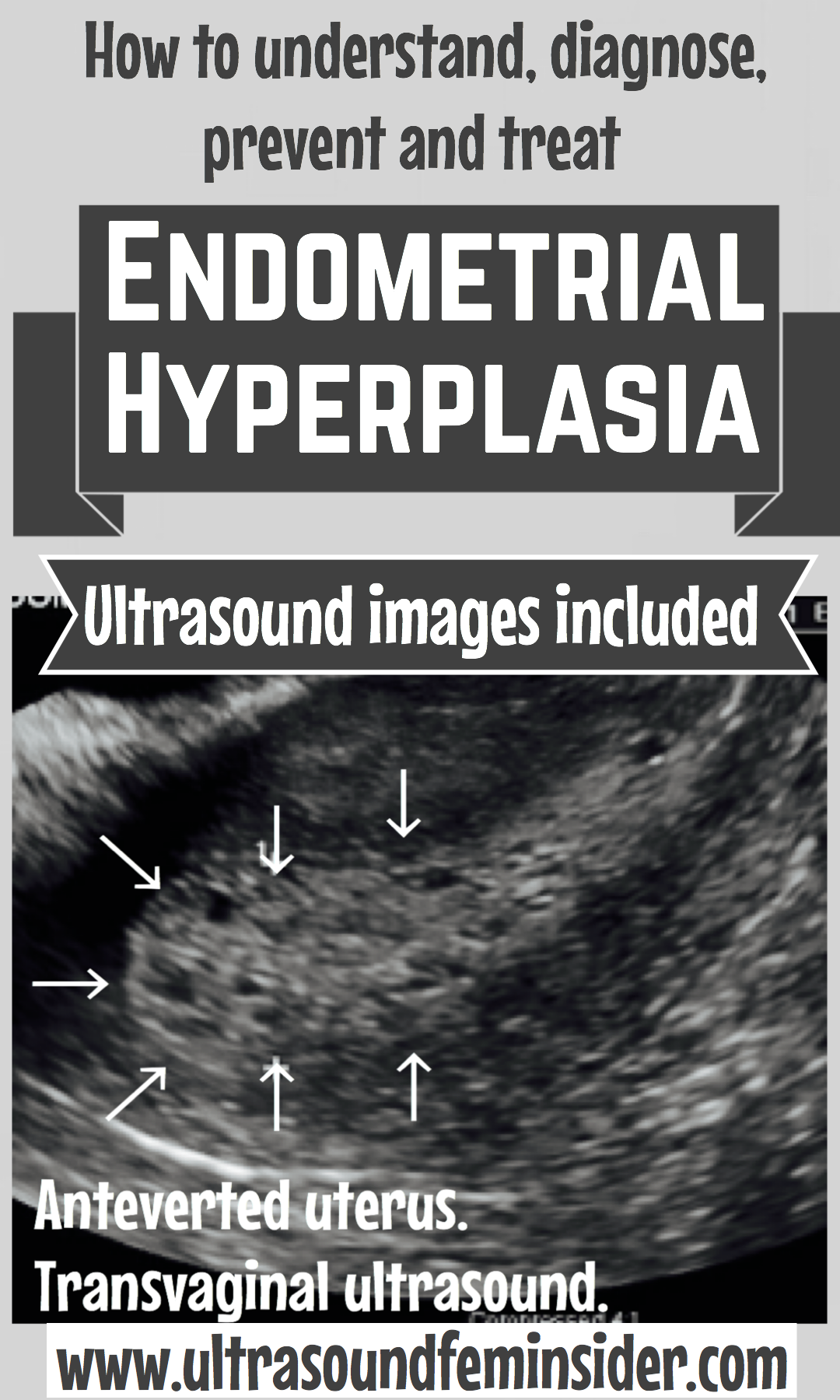 endometrial hyperplasia.