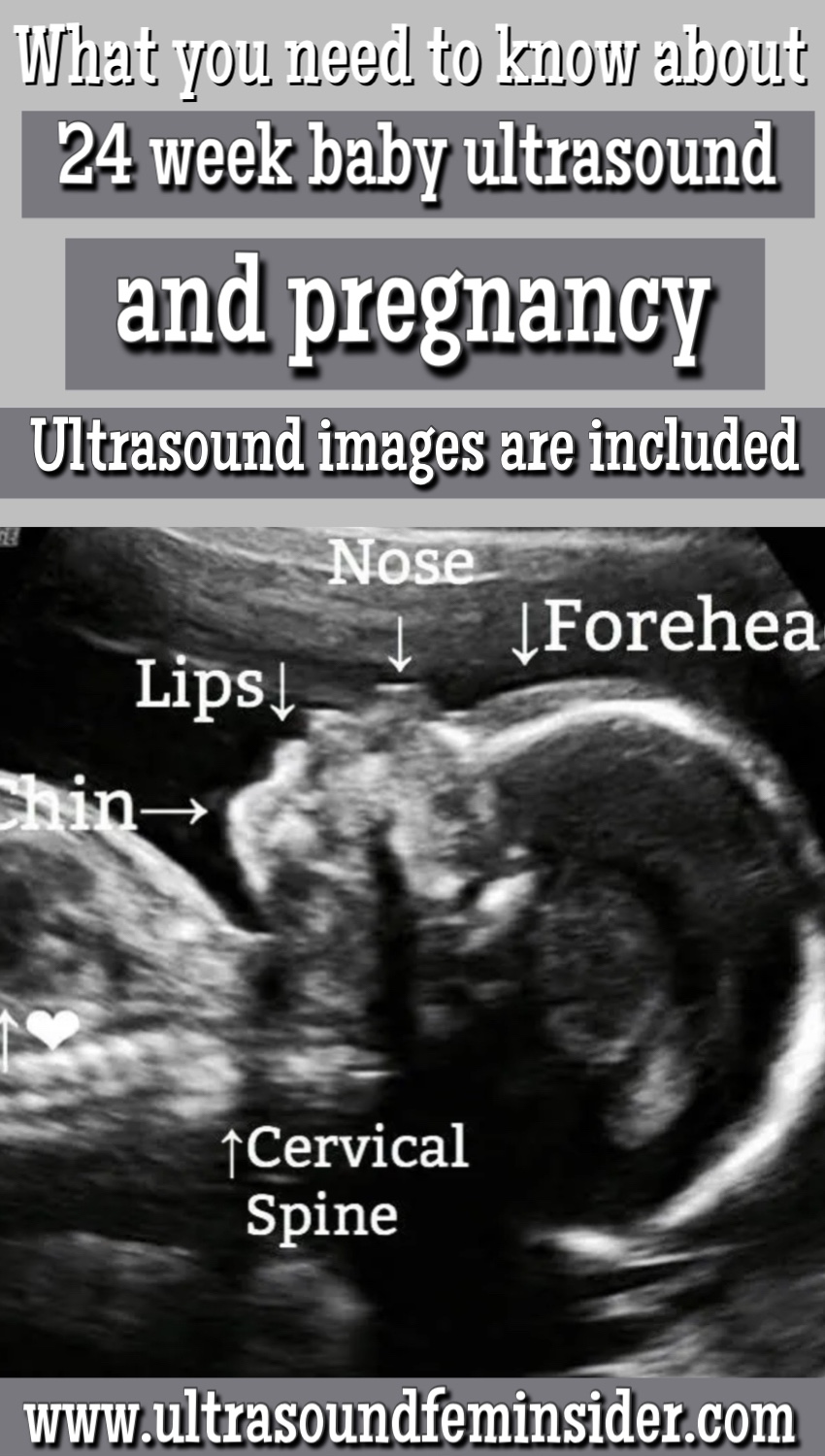 Normal 24 week baby ultrasound 