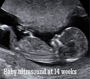 baby ultrasound at 14 weeks