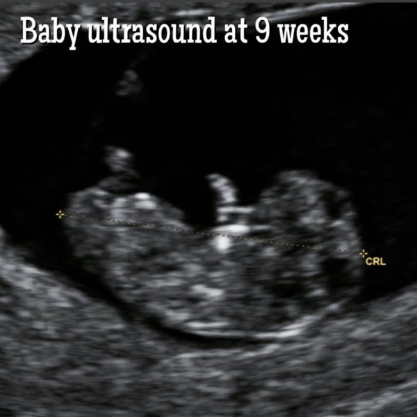 First Trimester Baby Development by Week. - Ultrasoundfeminsider