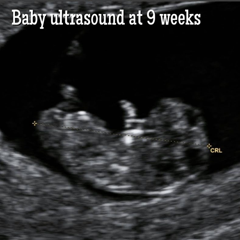 First Trimester Baby Development by Week.