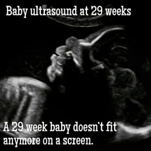 baby ultrasound at 29 weeks