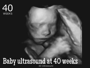 baby ultrasound at 40 weeks
