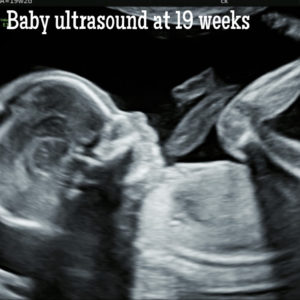 baby ultrasound 19 weeks