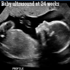 baby ultrasound 24 weeks