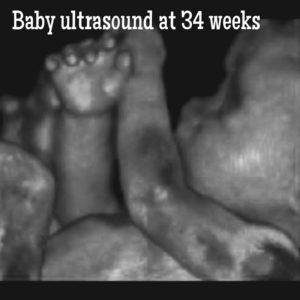 baby ultrasound at 34 weeks