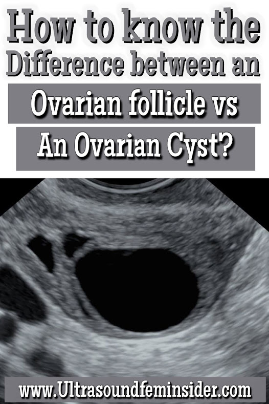 Ovarian Follicle vs an Ovarian Cyst? How to Tell the Difference.
